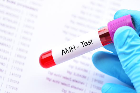 AMH-Test